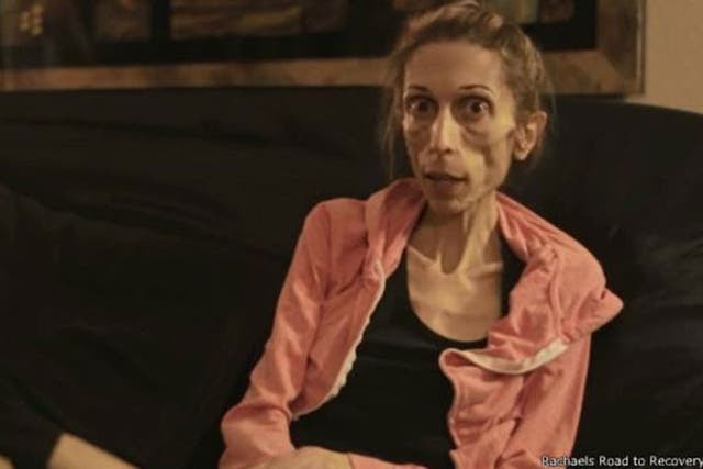 Rachael Farrokh, la actriz estadounidense de 37 años que pesando 20 kilos pidió ayuda online