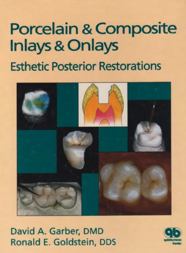 Porcelain & Composite Inlays & Onlays: Esthetic Posterior Restorations, by David A. Garber