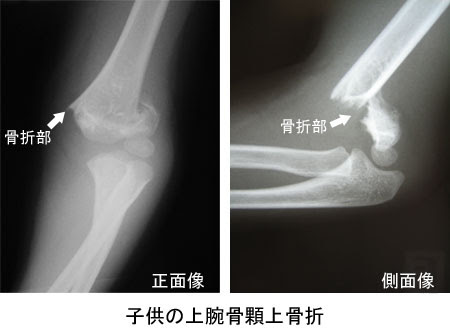 痛みの話q A 八王子整形外科 西八王子駅近くの整形外科専門クリニック