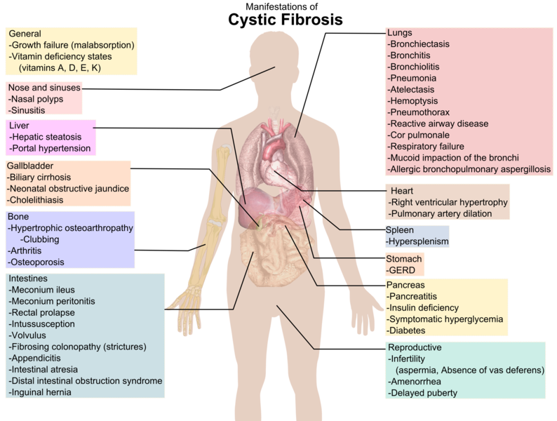 cystic fibrosis symptoms