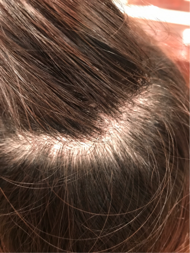 裏メニュー スキャルプエステ 続き Ambient Hair