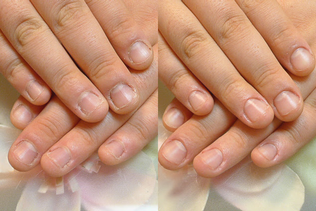 深爪矯正専門ネイルサロン Rifareリファーレ東京