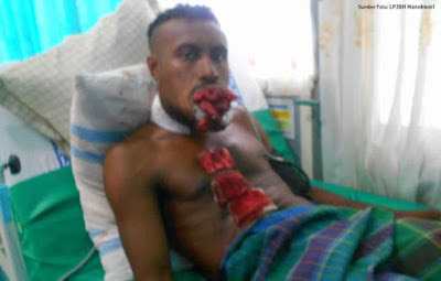 Erikson Inggabouw, Korban Penembakan Manokwari