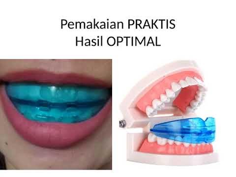 Best CARA OPTIMAL MERAPIKAN GIGI, viral!