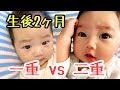[最も選択された] 赤ちゃん 一重 317535-赤ちゃん 一重 ショック