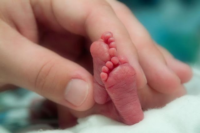 Parto agendado aumenta chance de nascimentos prematuros