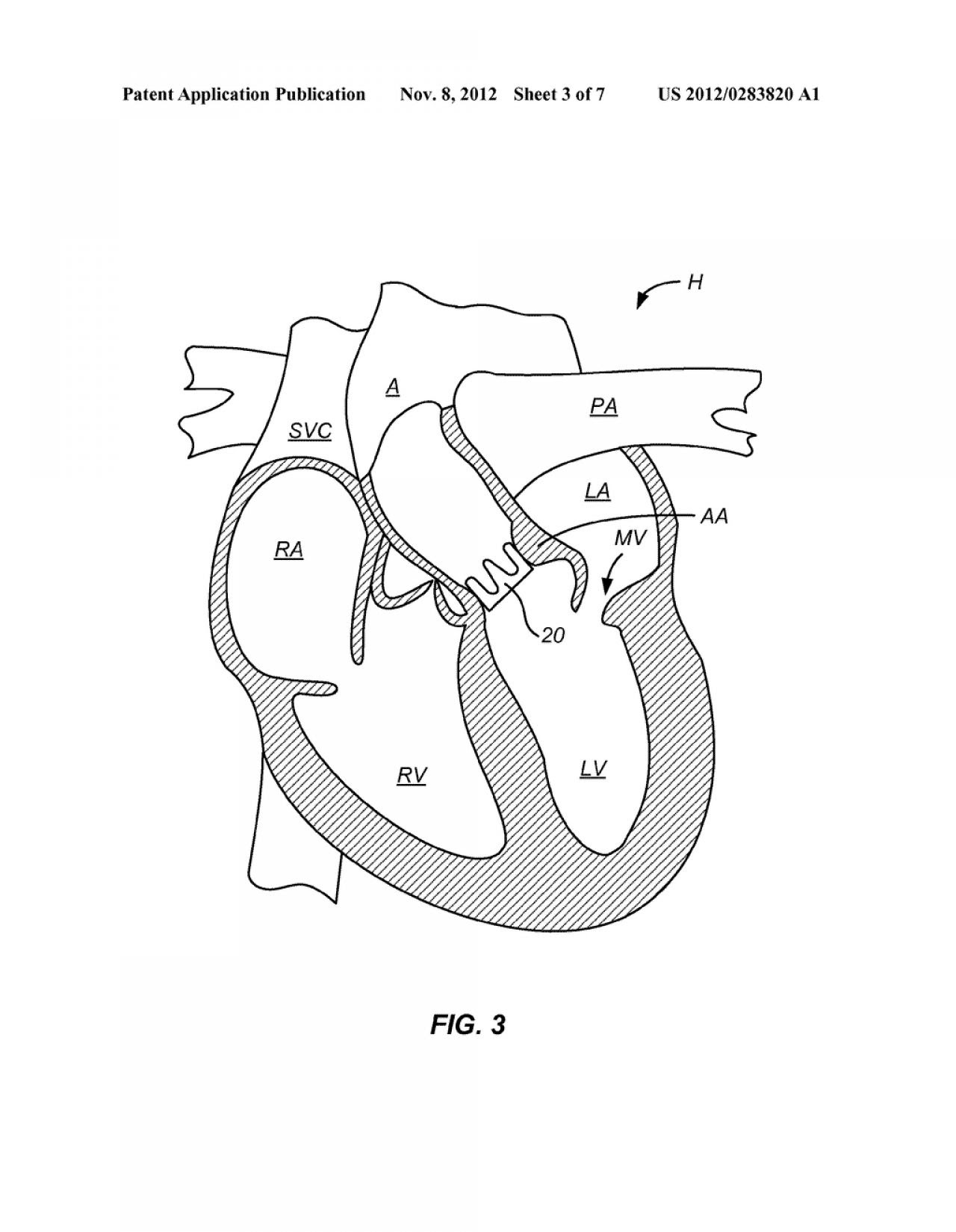 Simple Human Heart Drawing at GetDrawings | Free download