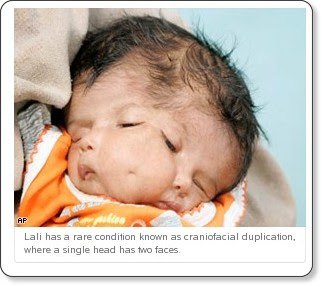 http://edition.cnn.com/2008/WORLD/asiapcf/04/08/baby.heads.ap/index.html?iref=mpstoryview#cnnSTCText