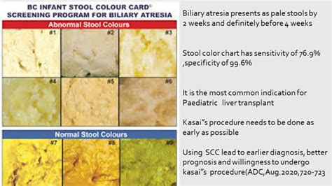 Only rarely does stool color indicate a potentially serious intestinal condition. stool color chart for adults chart colitis pinterest colour 12 free