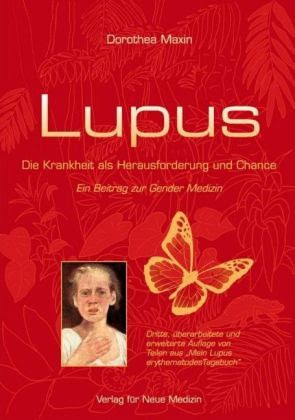 LUPUS Direkt: Lupus Electronics Installateur für Kameras und