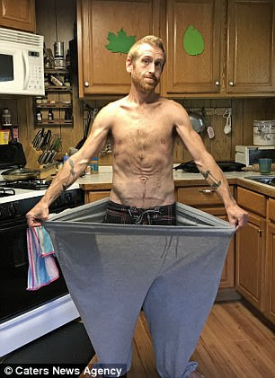 He's had 10 surgeries to get to where he is today