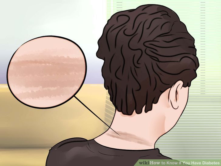 Know if You Have Diabetes Step 6.jpg