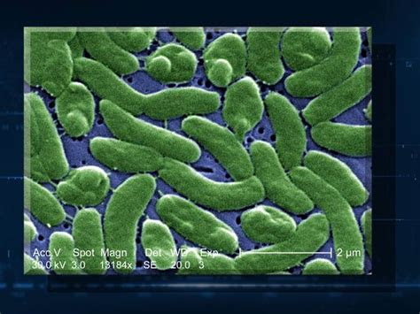 deadly bacteria   beach video  nbcnewscom