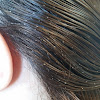 Eyelash Lice - Ø§ÙÙØ§Ø¹ Ø§ÙÙÙÙ Ø¨Ø§ÙØµÙØ± : We may earn commission from links on this page, but we only recommend produc.