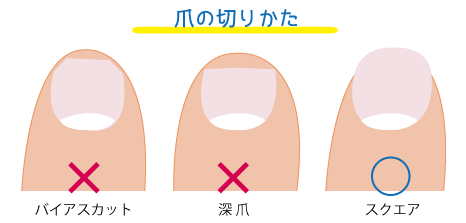 爪でわかる 病気のサイン 不妊子宝相談 生活習慣病 めまい 咳 胃腸症状が得意な坂重薬局