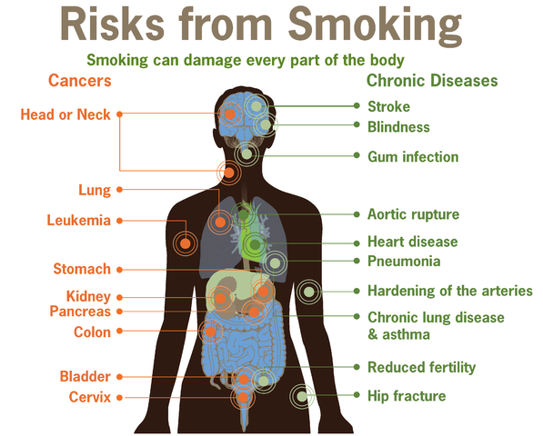 http://upload.wikimedia.org/wikipedia/commons/thumb/9/92/Risks_form_smoking-smoking_can_damage_every_part_of_the_body.png/597px-Risks_form_smoking-smoking_can_damage_every_part_of_the_body.png