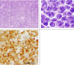Phase I study of ipilimumab, an anti-CTLA -monoclonal antibody, in