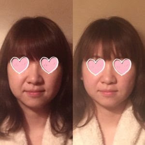 小顔矯正 静岡市葵区の美人小顔矯正ならアロマリンパエステ 整体サロンひつじ堂