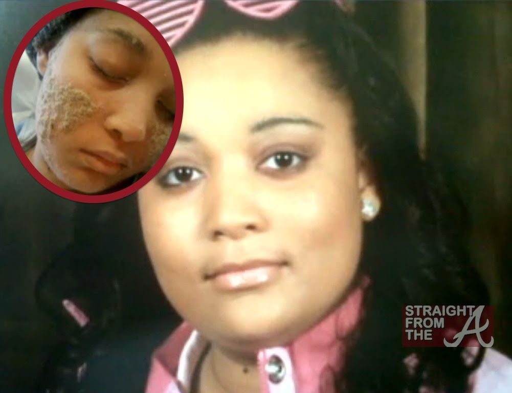 stick kenya on nails Grow Woman Fingernails OMG?!? Where Strange Develops Condition From