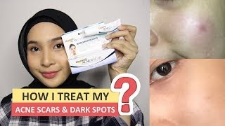dermatix acne scar price