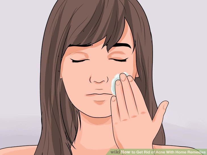 Get Rid of Acne With Home Remedies Step 3.jpg