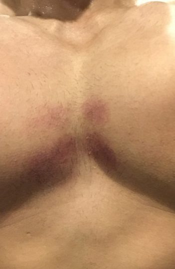 楽しくてテンションが上がり過ぎた日のワークアウトで思わぬところを痛めた件 ユダマッスルの今日も頑張りマッスル ユダマッスルの今日も頑張りマッスル