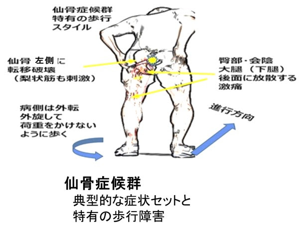 痛みがとれない時にどうするか 中京病院 症状コントロールガイド