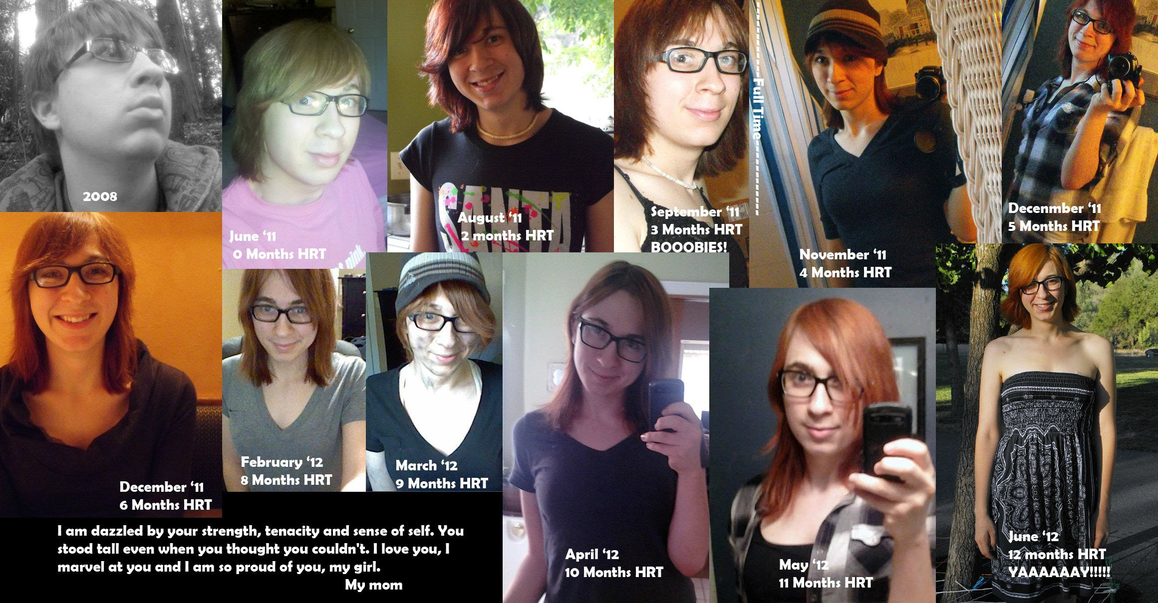 Transgender Transitions | Transgender Transition Timelines ...