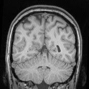 brains!