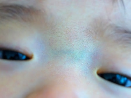 眉間の青筋 疳が強い 赤ちゃんの話 泣き虫 疳の虫 何の虫 でんでんデンマーク子育て日記