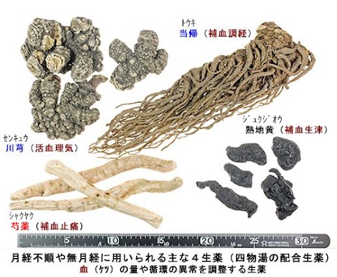 生理 が こない 子宮 が 痛い