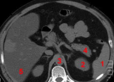 oncologie olv aalst