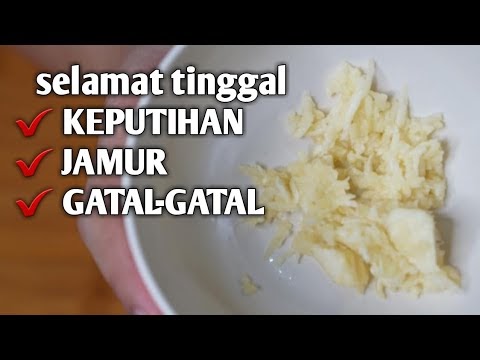 obati keputihan dengan bawang putih
