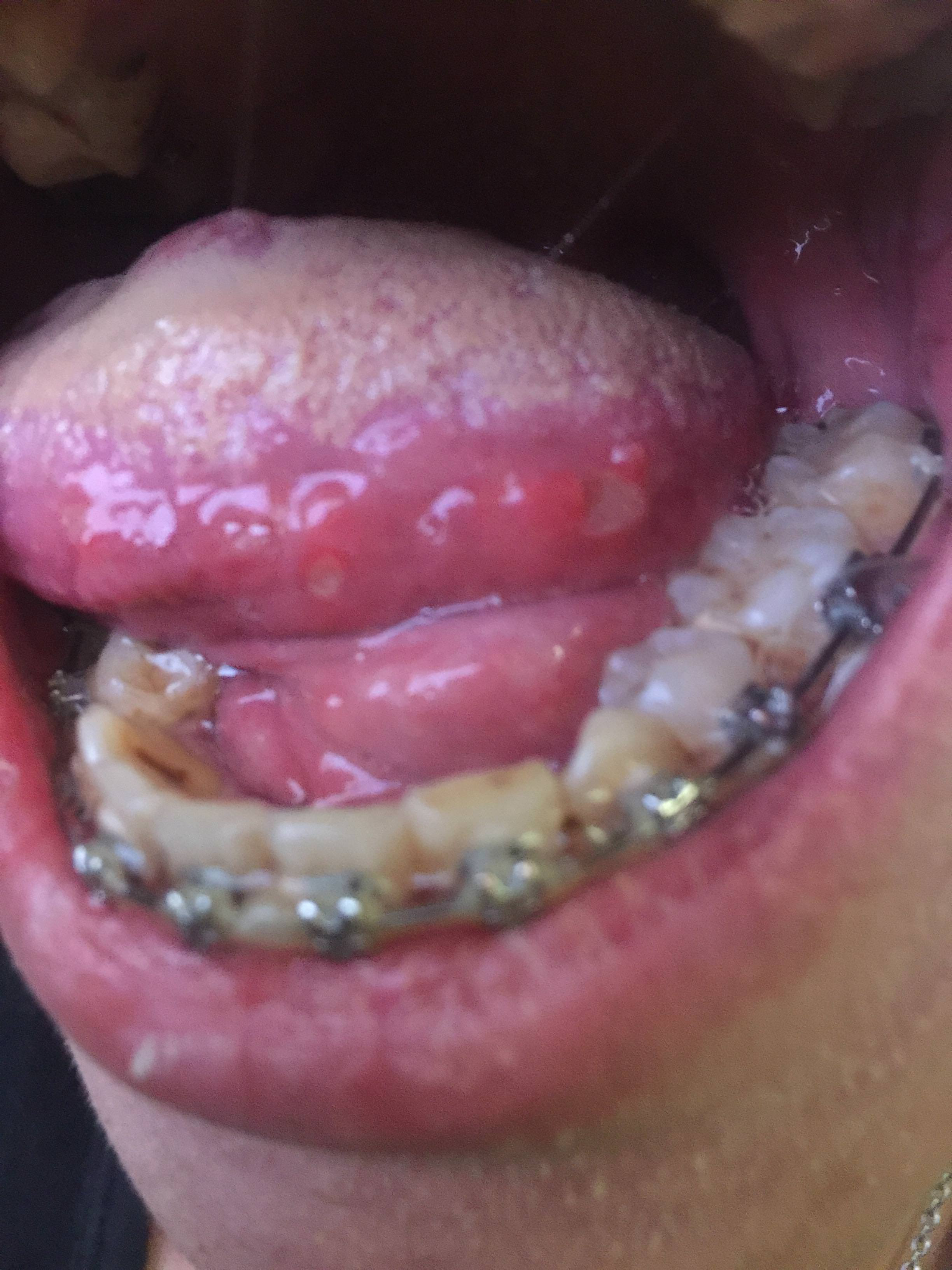 爆卦 如果你也跟我一樣嘴破十幾年 文長 Gossiping板 Disp s