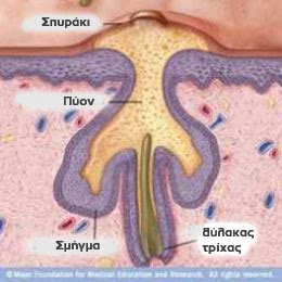 δέρμα