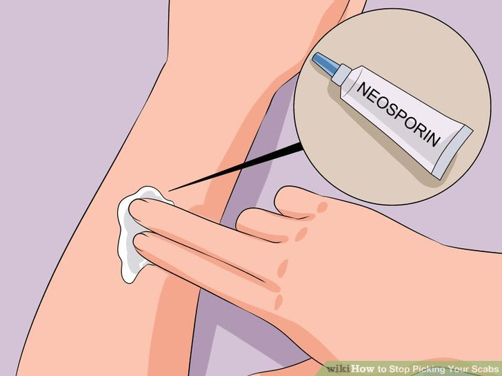 Stop Picking Your Scabs Step 1 Version 2.jpg