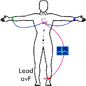 Distribuir contenido