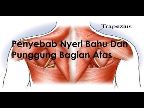 sakit punggung sebelah kiri