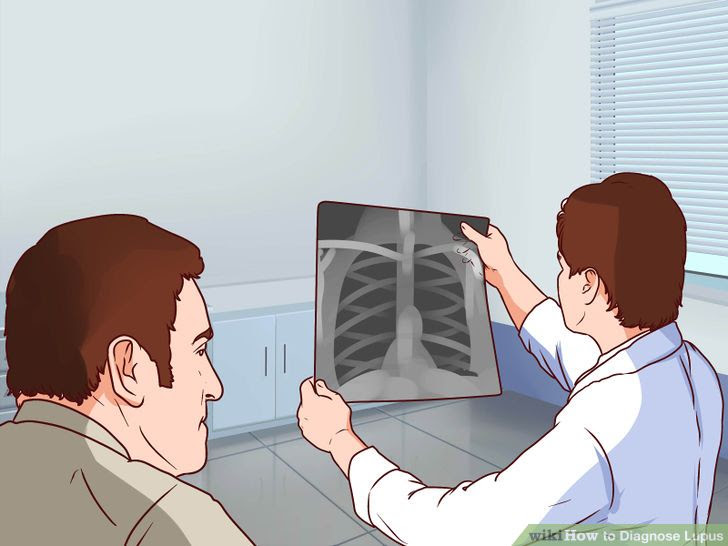 Diagnose Lupus Step 14 Version 2.jpg