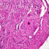 Histology Of Smooth Muscle Diagram : Smooth Muscle Diagram Labeled - Draw A Labelled Diagram Of ... / Neurotransmitter activitation of smooth muscle is fairly diffuse.