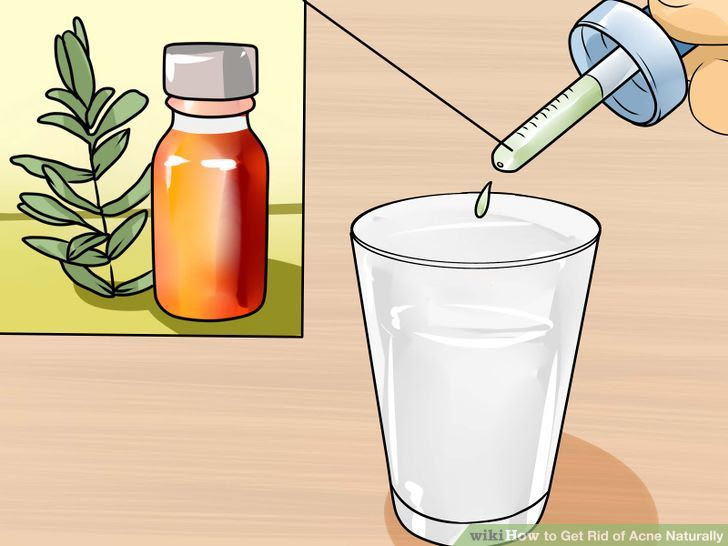Get Rid of Acne Naturally Step 25.jpg