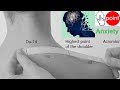 Best Acupressure Points for Stress Relief and Anxiety