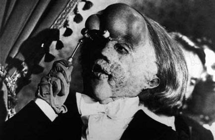elephant man 1