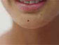 Mole