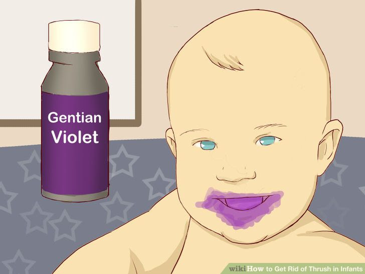 Get Rid of Thrush in Infants Step 10 Version 2.jpg