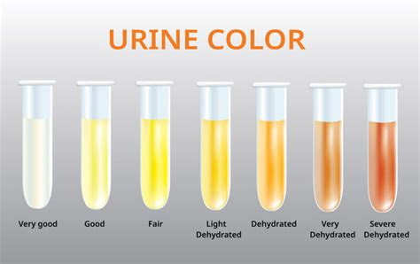  4141 best urine color images stock photos vectors adobe stock