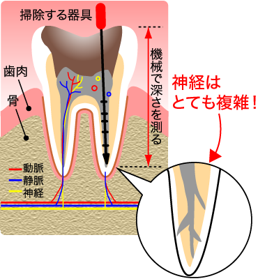 当院では最新鋭歯科用ctを導入しております 東大阪 石切駅前 徒歩１分 Newスタイル鈴木歯科医院 072 980 4000 親知らずを静脈麻酔鎮静法で楽々寝ながら抜歯 オールセラミック 35 000 80 000 再生治療付きインプラント年間100症例 目立たない保険の入れ歯