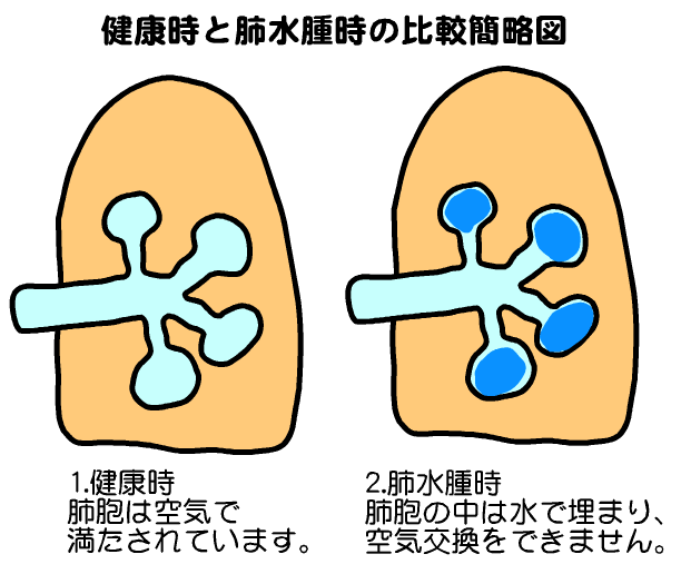 じじぃの 肺水腫 ポッコリお腹 飢餓状態でなくともお腹が膨らむのは 理系の話 Cool Hira S Diary