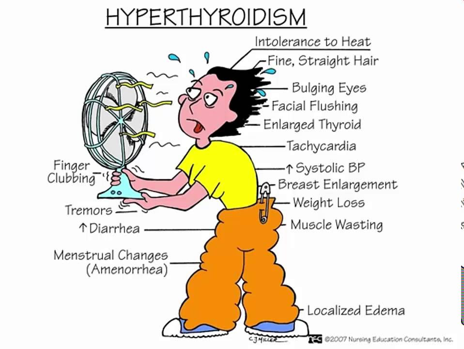 Thyrotoxicosis You and Your Hormones from the Society