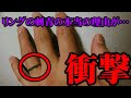 √100以上 タトゥー 指 意味 194087-タトゥー 指 意味